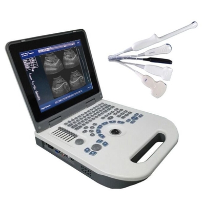 TGC Control Notebook Máy quét siêu âm cho thai phụ sử dụng tại nhà