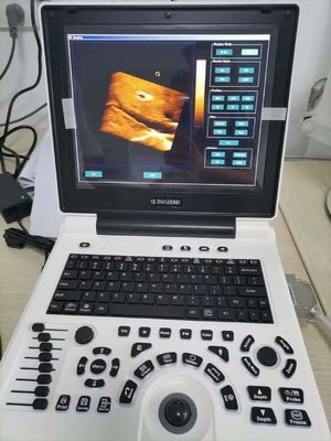 Hình ảnh Máy siêu âm Doppler màu Xianfeng mang thai 4B OEM
