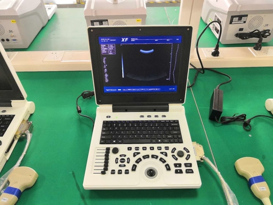 Máy quét siêu âm chẩn đoán công nghệ 12.1in Pin Li