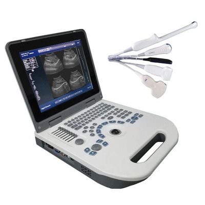 Chất lượng  TGC Control Notebook Ultrasound Scanner For Pregnancy Home Use nhà máy
