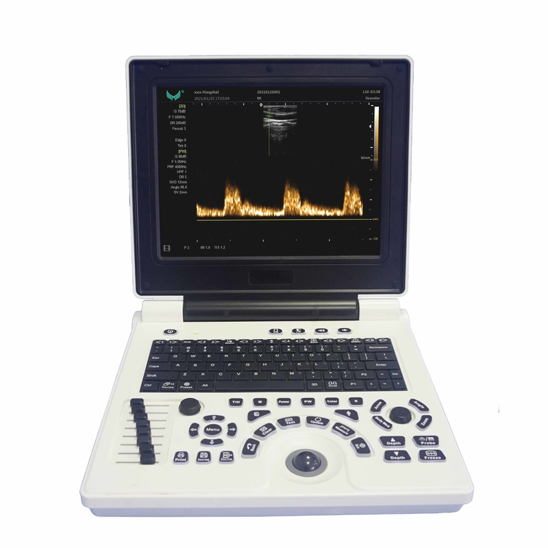 Máy siêu âm Doppler màu cầm tay OB GYN trong thai kỳ