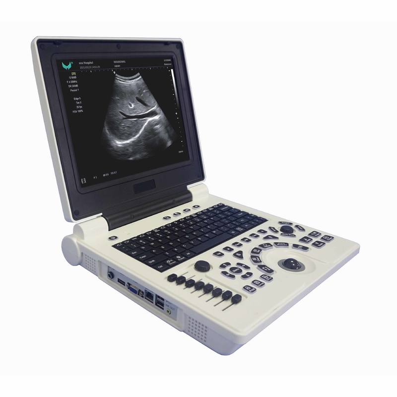 Máy siêu âm Doppler màu cầm tay OB GYN trong thai kỳ