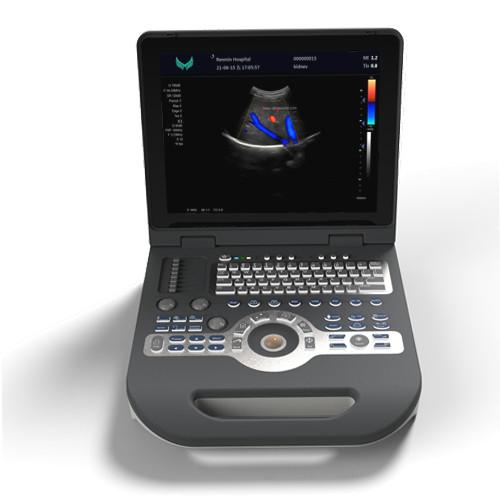 Máy quét siêu âm màu tim mạch SGS Thiết bị siêu âm Doppler cầm tay 220V