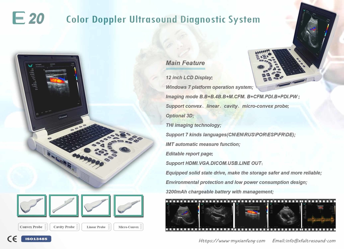 Cấp độ cơ bản ISO Máy USG di động Hệ thống siêu âm Doppler màu kỹ thuật số