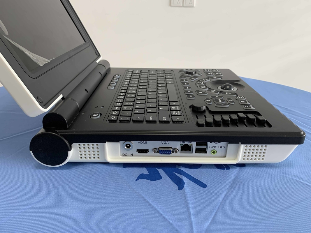 Cấp độ cơ bản ISO Máy USG di động Hệ thống siêu âm Doppler màu kỹ thuật số