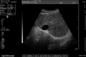 Máy siêu âm mang thai tại nhà y tế Máy siêu âm hình ảnh DRF RDA Cổng USB