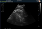 Máy siêu âm mang thai tại nhà y tế Máy siêu âm hình ảnh DRF RDA Cổng USB