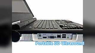 Bệnh viện lâm sàng siêu âm cầm tay E20
