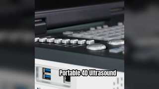 Máy siêu âm Doppler 4D cầm tay ICU đã sẵn sàng
