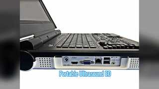 Siêu âm Doppler màu cầm tay E0 Quét tiết niệu